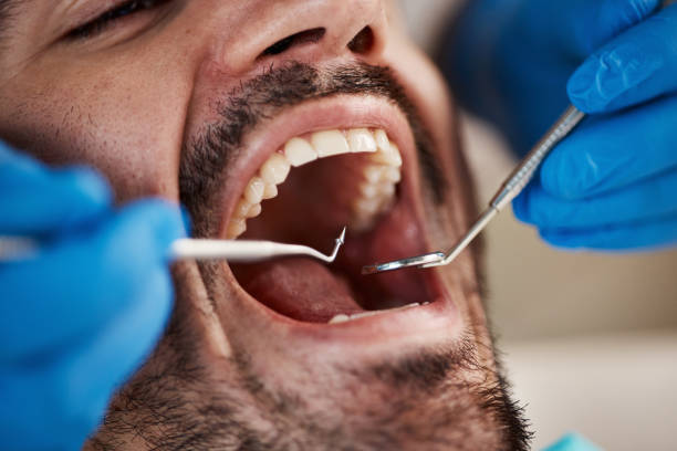 Best Emergency Tooth Extraction in Koontz Lake, IN