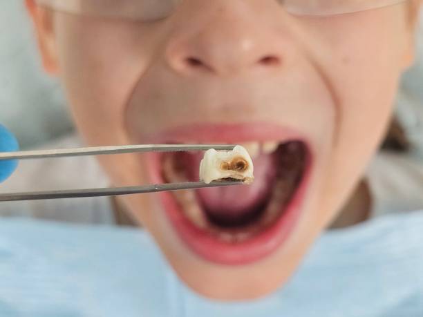Best Weekend Emergency Dentist in Koontz Lake, IN
