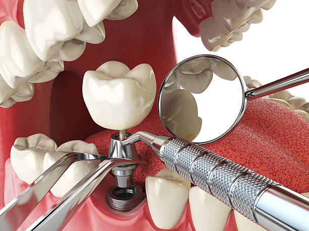 Reliable IN Emergency Dentist Solutions
